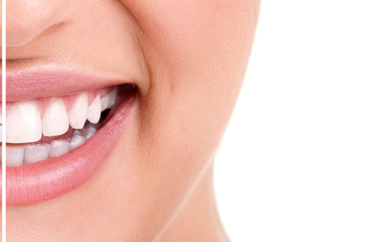 Healthy smile with braces | White Oak Dental Clinic | Calgary AB