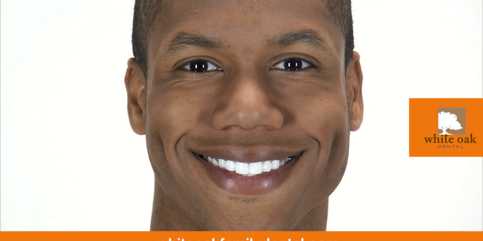 white-oak-smile-video.00_00_03_04.Still001 Video Thumbnail | White Oak Dental Clinic | Calgary AB