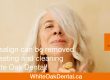 SW Calgary Dental Invisalign | White Oak Dental Clinic | Calgary AB
