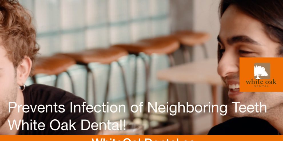 white-oak-dental-root-canal-02.00_00_09_20.Still043 Root Canal Services SW Calgary | White Oak Dental Clinic | Calgary AB