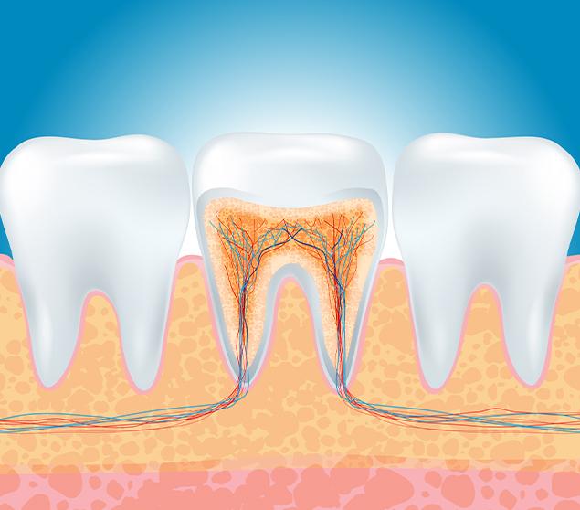 Managing Infection and Restoring the Tooth Root Canal Therapy | White Oak Dental | General Dentistry SE Calgary